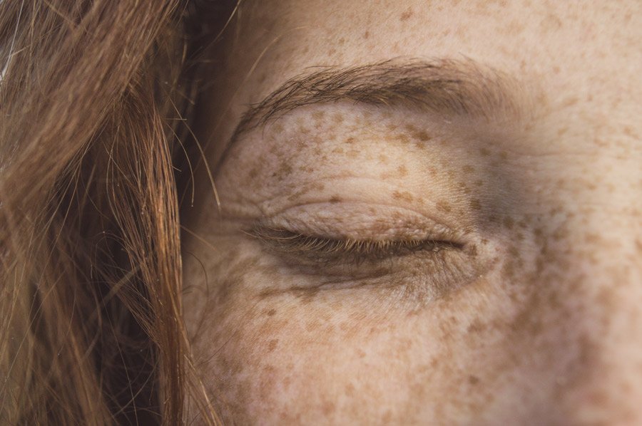 Polo Salute Lucca | Dermatologia