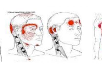 Polo Salute Lucca | Trigger points