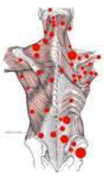 Polo Salute Lucca | Trigger points