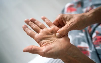Morbo di Dupuytren e Riabilitazione Fisioterapica Polo Salute Lucca | Morbo di Dupuytren e Riabilitazione Fisioterapica