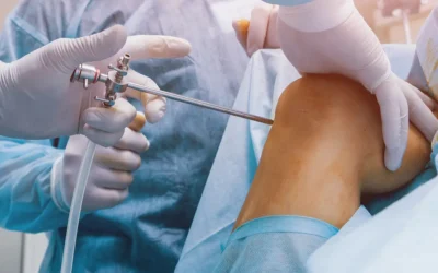 Polo Salute Lucca | Meniscectomia: la fisioterapia fa la differenza nel recupero!